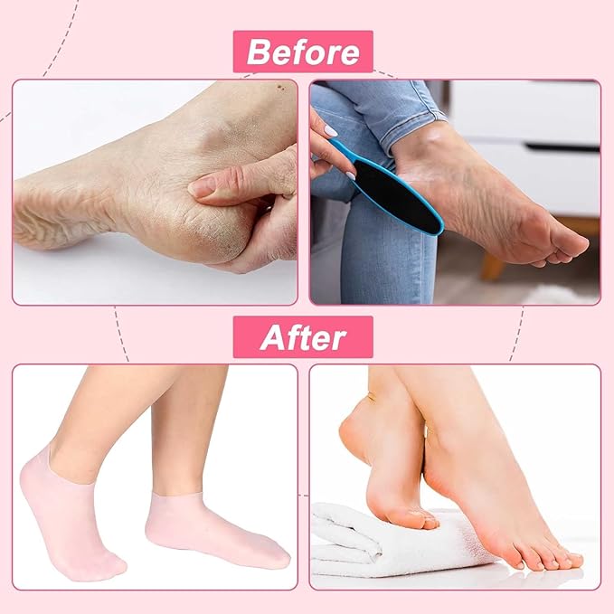 Premium Multicoloured Natural Oil Spa Gel Socks (Pack of 2)